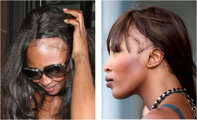 Comme laver les huiles des cheveux